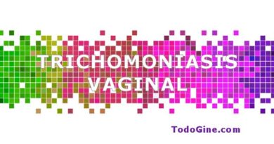 Trichomoniasis vaginal