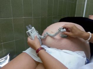 Auscultacion latido fetal con ultrasonidos